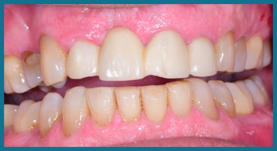 smile before dental treatment