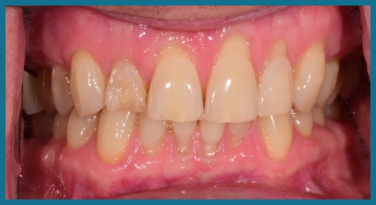 smile before dental treatment