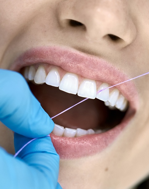 Dental hygienist flossing smiling patient's teeth