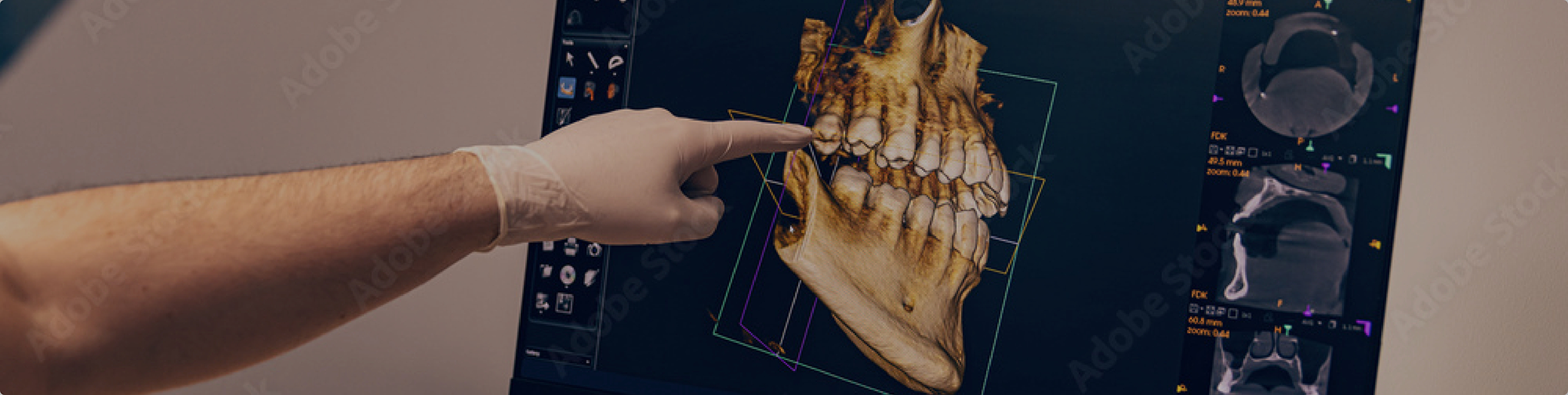 Gloved hand pointing to a dental X ray